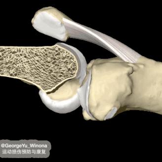 类风湿性关节炎和老寒腿一样么,老寒腿风湿关节炎