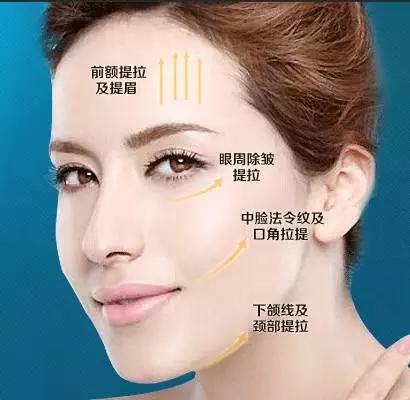 什么是线雕美容过程,什么是线雕眉