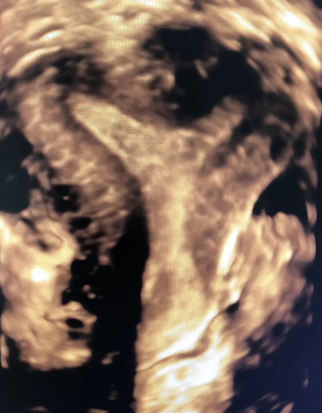 渭南妇幼四维彩超电话,渭南市妇幼保健院四维单子