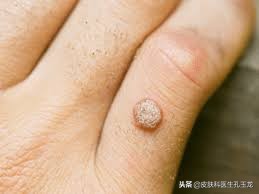 微量元素锌有什么作用,人体对微量元素锌的吸收率高吗