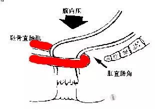 “上大号”是蹲好还是坐好？华西医生教你健康拉粑粑