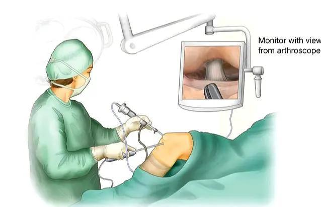 老人膝盖疼平时应怎么样康复锻炼,老年人膝盖后面肌肉疼痛怎么回事