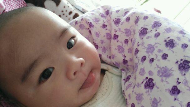 宝宝长期调理脾胃为什么脸色还黄,脾胃虚脾胃消化弱脸上有什么表现