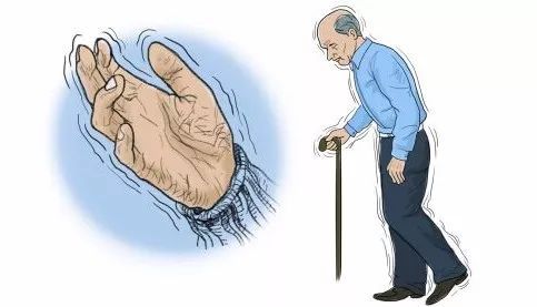 老年人手抖都是帕金森引起的吗,年轻人手抖记忆力差是不是帕金森