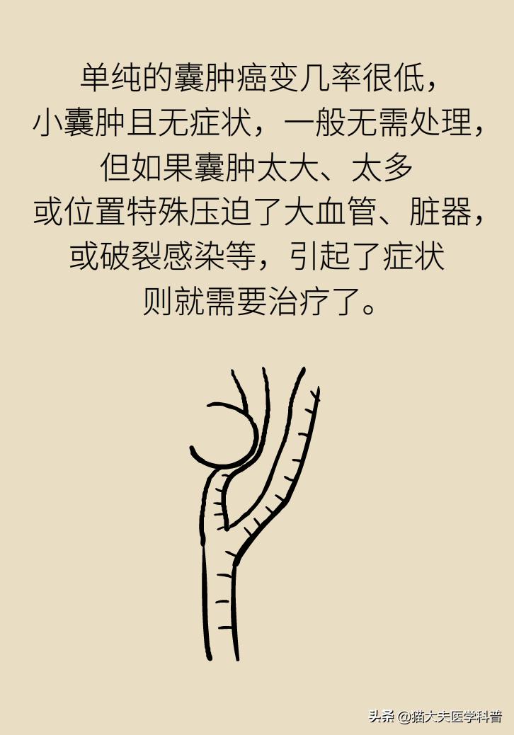 结节囊肿息肉的区别,结节增生囊肿息肉哪种癌前病变