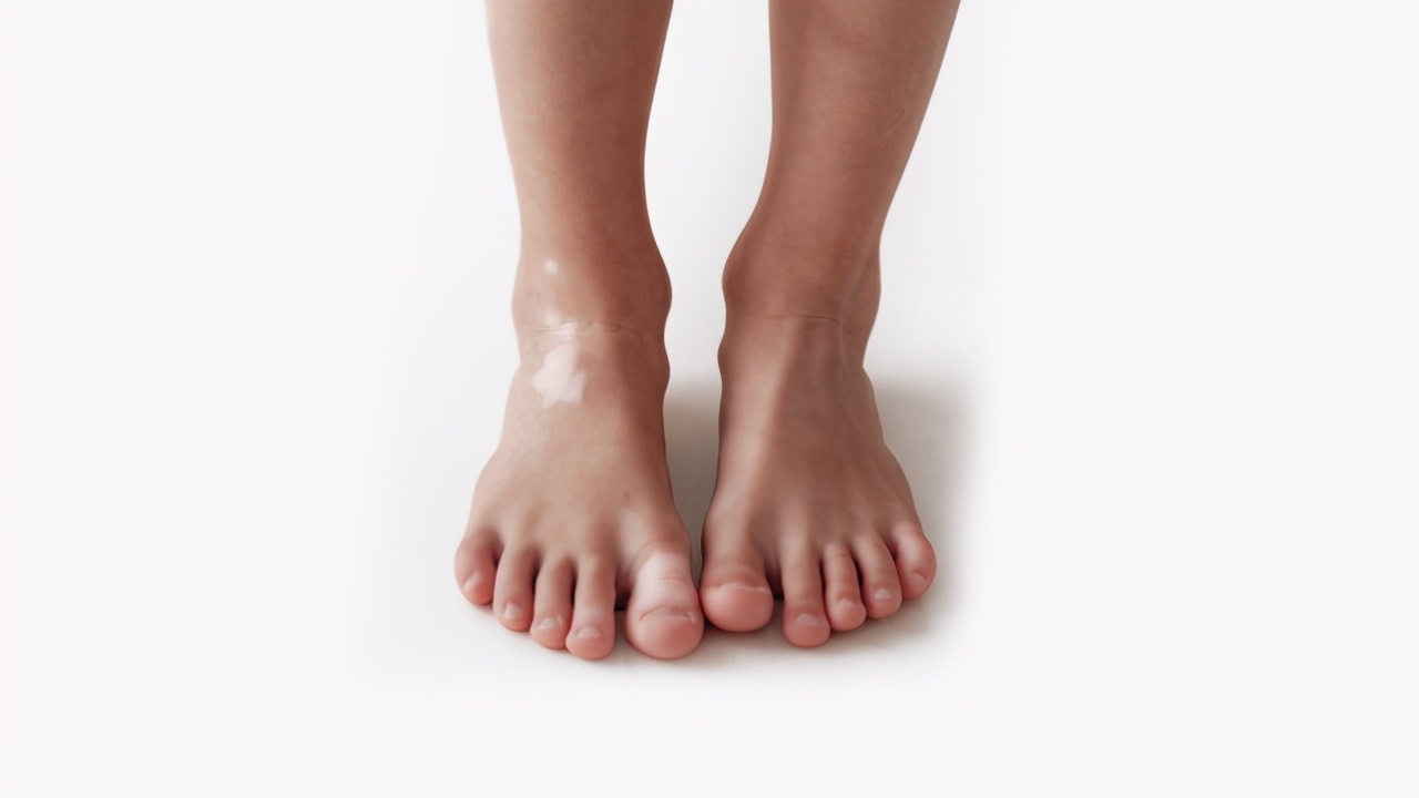 白癜风皮肤问题,皮肤白斑和白癜风能治好吗