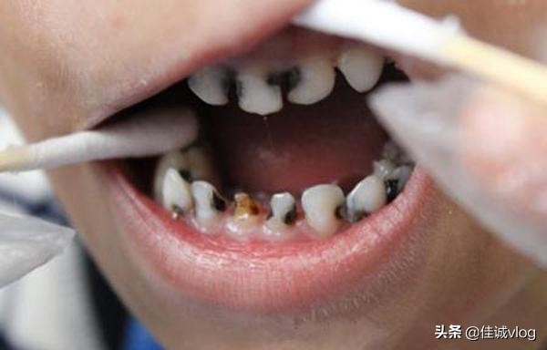 7岁小男孩牙疼哭,7岁孩子牙疼医生说不建议治疗