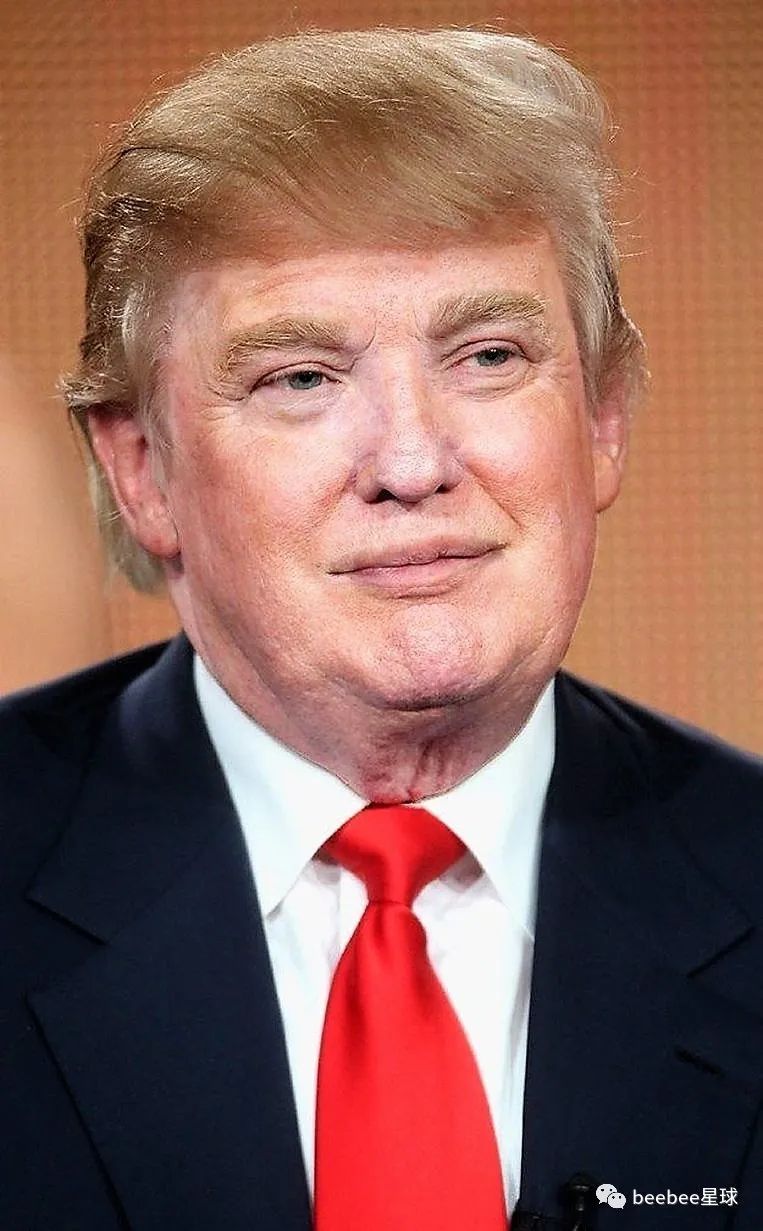 为什么老特的眼袋是白色的？