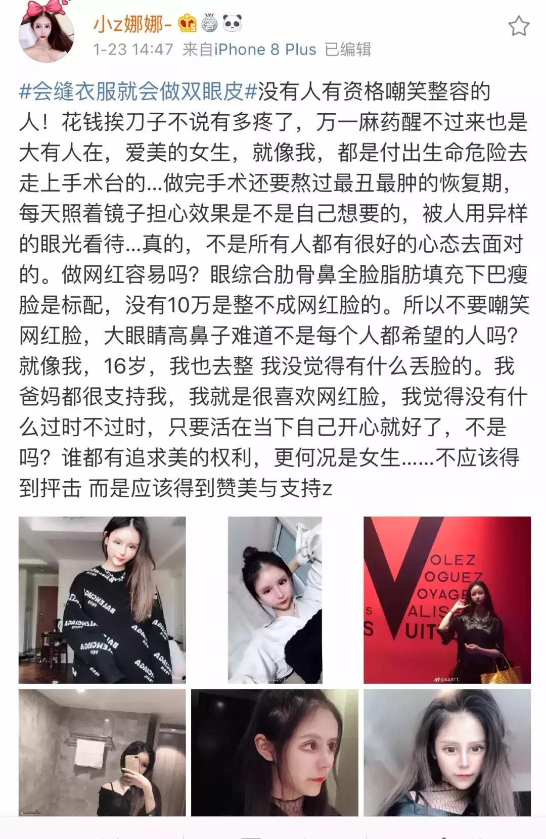 13岁开始整容，视李蒽熙为偶像！小Z娜娜是疯了吗？