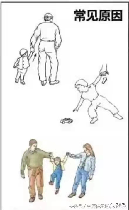 小儿桡骨小头半脱位图,桡骨小头半脱位复位最佳时间