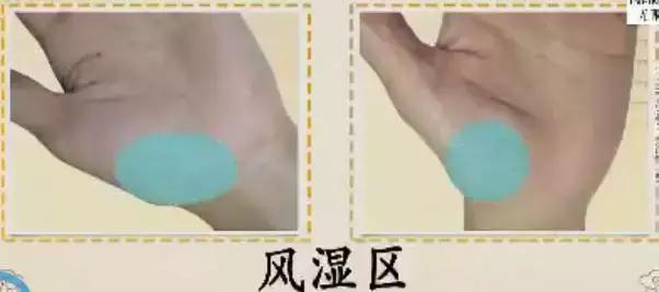 手诊10种常见病从手上就能看出来,如何辨别手掌的健康