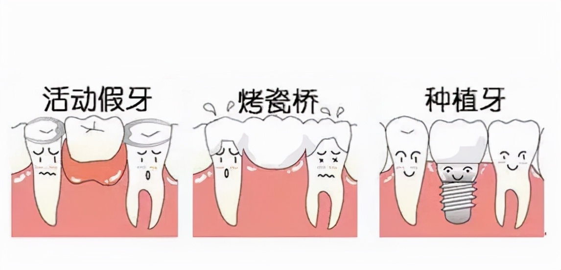 老人做种植牙有什么年龄限制吗,老年人做种植牙有什么风险