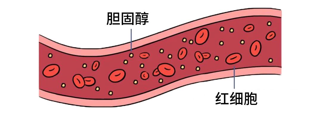 血脂多少需要吃药降血脂,血脂多少必须吃降血脂的药