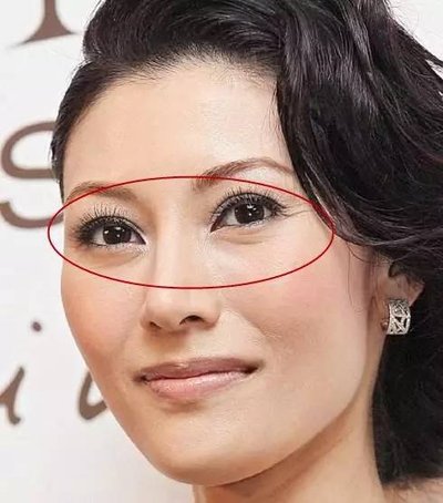 治眼袋皱纹最好的软膏,28岁的女生小细纹用什么抗衰祛皱