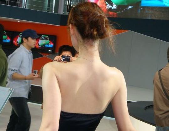 背后暗沉还老是长痘怎么办？不要害怕，我来帮助你