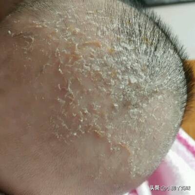 新生儿这八大身体部位极需重点呵护