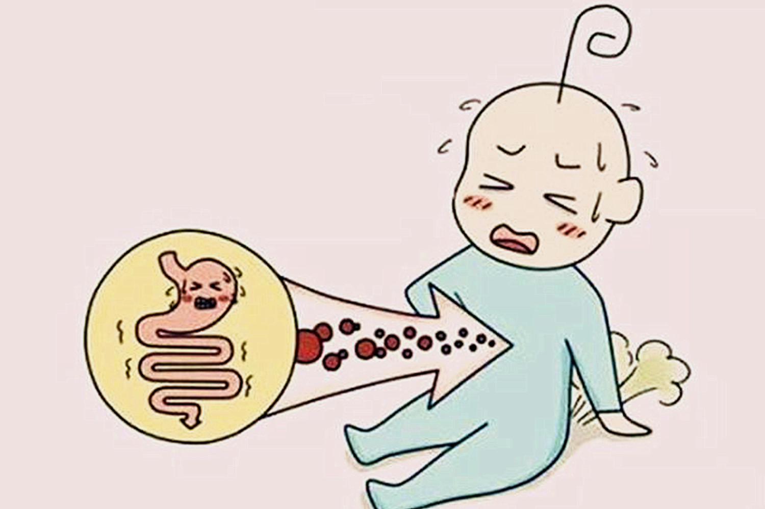 宝宝不放屁通气会发烧吗,宝宝放屁不臭什么原因