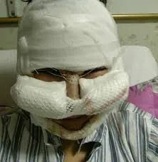 整容也就图一乐，真投胎还得买神水