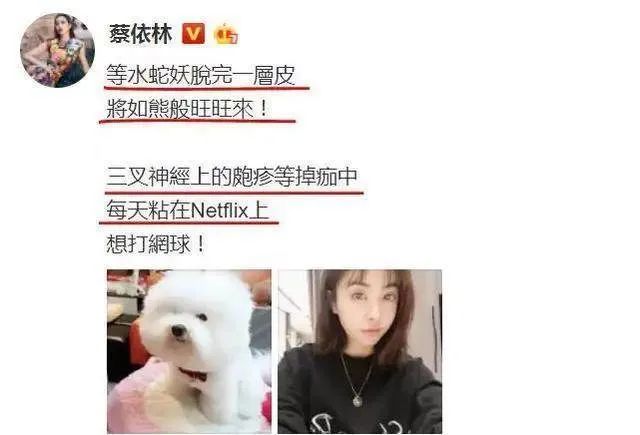 蔡依林、马思纯纷纷中招？痛如刀割的带状疱疹，真的致命吗？