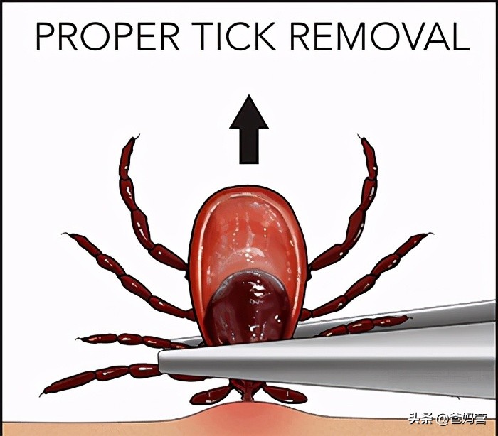 妈妈一拍小孩差点毁容,妈妈拍到孩子的恐怖画面