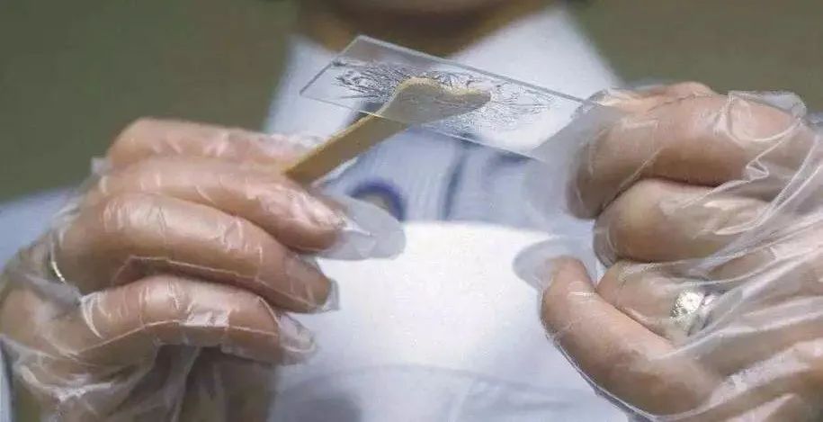 宫颈筛查做哪两个项目,宫颈筛查的注意事项