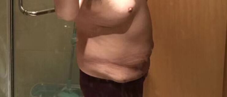 节食减肥下来皮肤松弛怎么办,节食减肥后皮肤松弛能吃回来吗