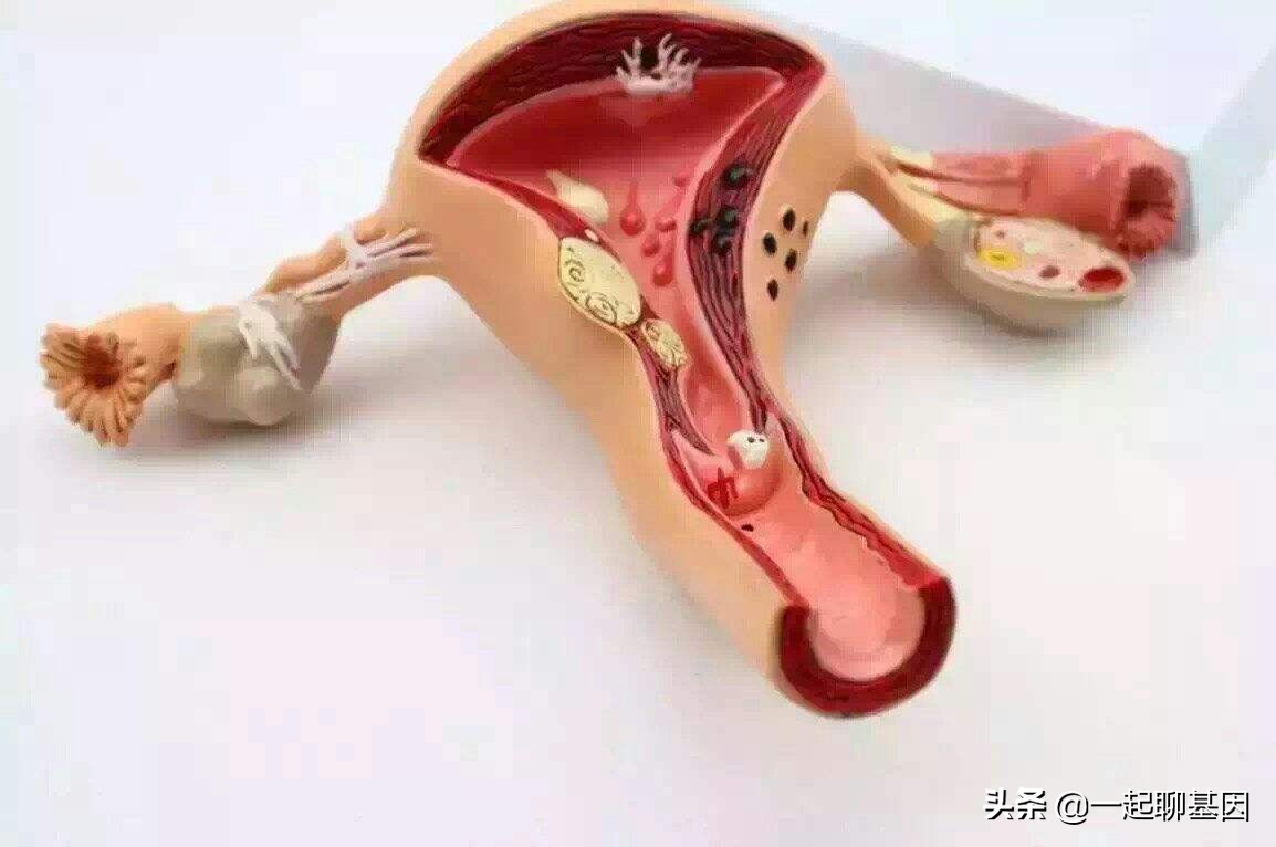 子宫肌瘤什么原因会越长越大,子宫肌瘤医生为什么建议切除子宫