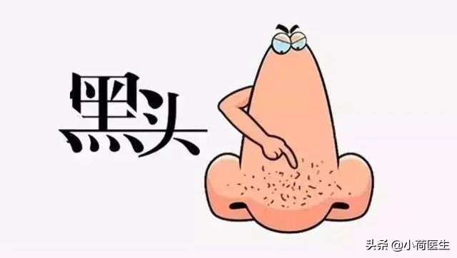 顽固的黑头用祛黑头仪真的能行吗,黑头的成因以及祛黑头的方法