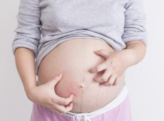 孕妇油预防妊娠纹,孕妇怎样预防妊娠纹抹什么