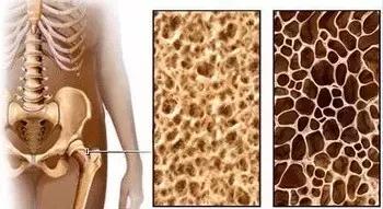 桂枝茯苓丸配归脾丸逍遥丸可以吗,逍遥丸归脾丸桂枝茯苓丸有啥区别