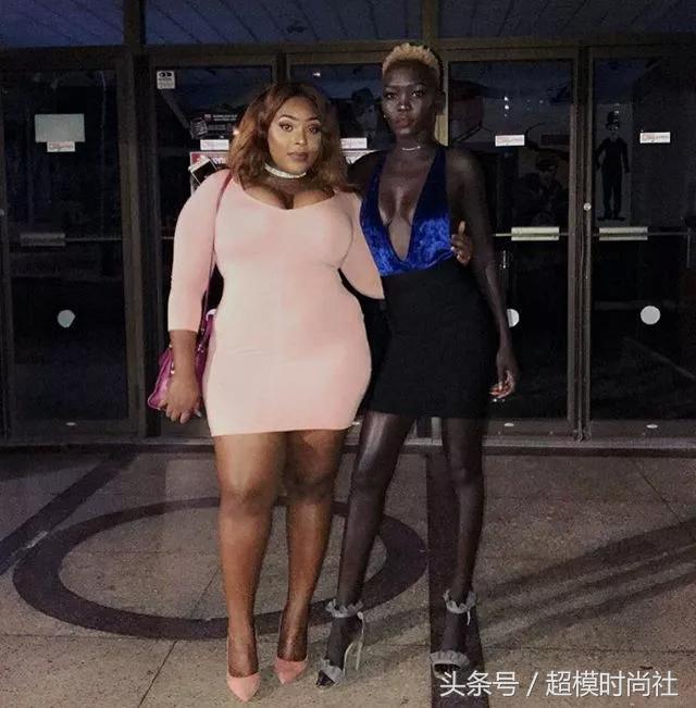 她连牙龈都是乌黑的！但她却敢反歧视，活成INS大热的模特女王