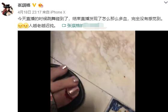 主播张琪格直播跳舞，脚出血了浑然不知，网友感言：都不容易！