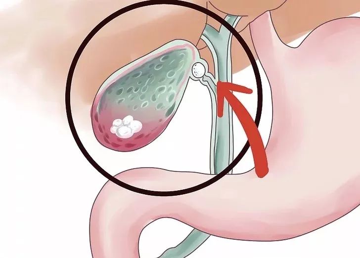 肝癌初期身体的四个症状藏不住,不痛不痒的肝癌是良性还是恶性