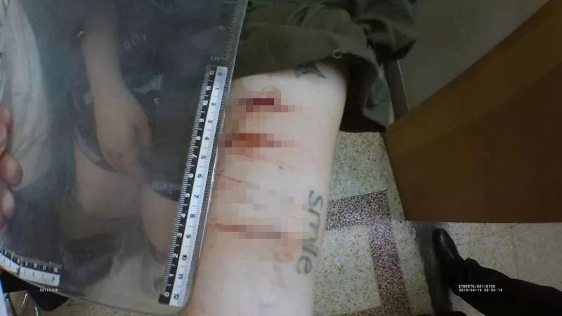 杭州3女1男手臂割伤，眼圈发黑送医！警察推开房门惊呼：不要命了！