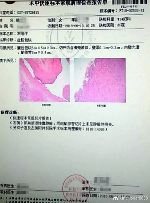 动画演示子宫全切手术,子宫附件全切术动画