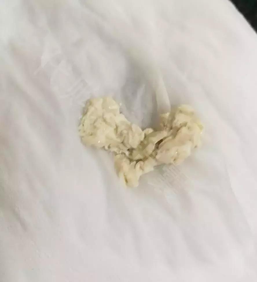 雅培小安素是固体饮料吗,雅培小安素是奶粉还是营养粉
