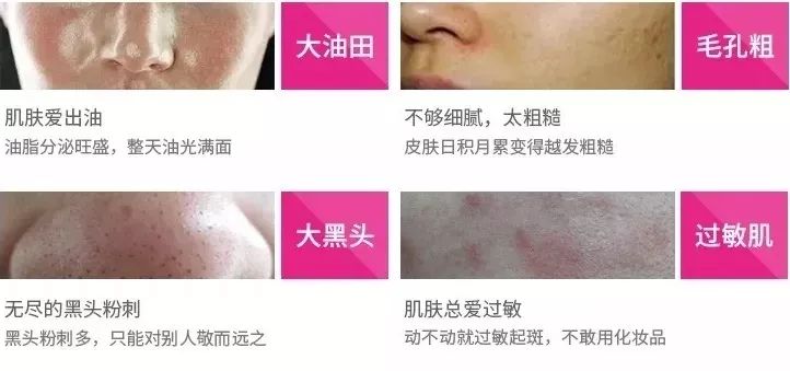 luna洁面仪最新款,亲测好用四款洁面