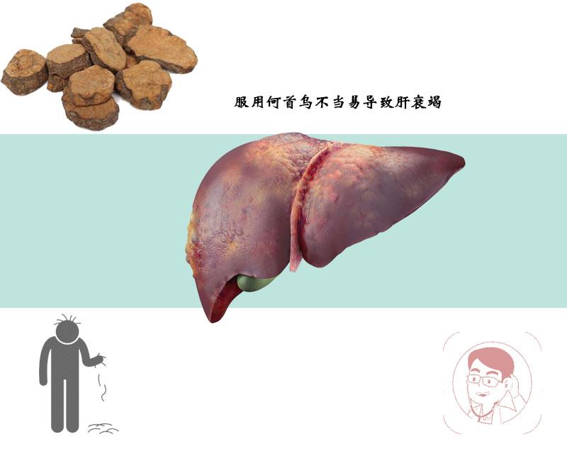 肝衰竭有哪些中药禁忌,肝衰竭肝硬化肝腹水中药能治吗