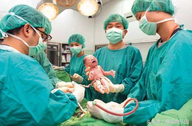 二胎剖宫产需要准备什么,二胎剖腹产孕妈注意事项