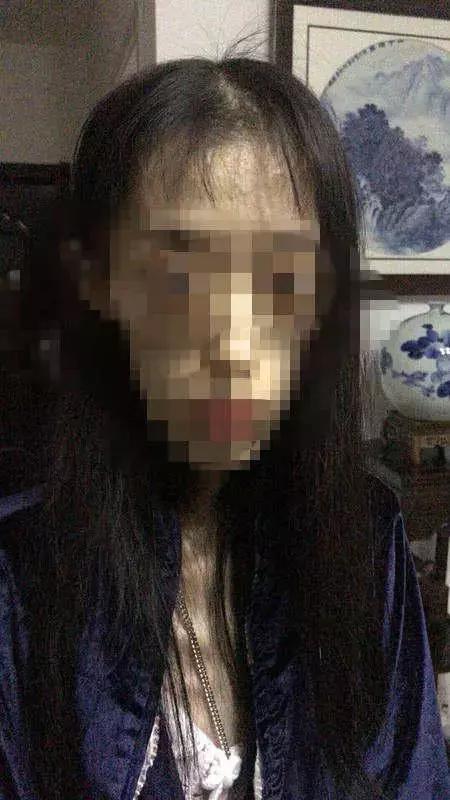身高1.67米，体重50斤，21岁女孩“自杀式减肥”