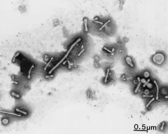 一些不存在的生物,无处不在的微生物究竟靠啥活着呢