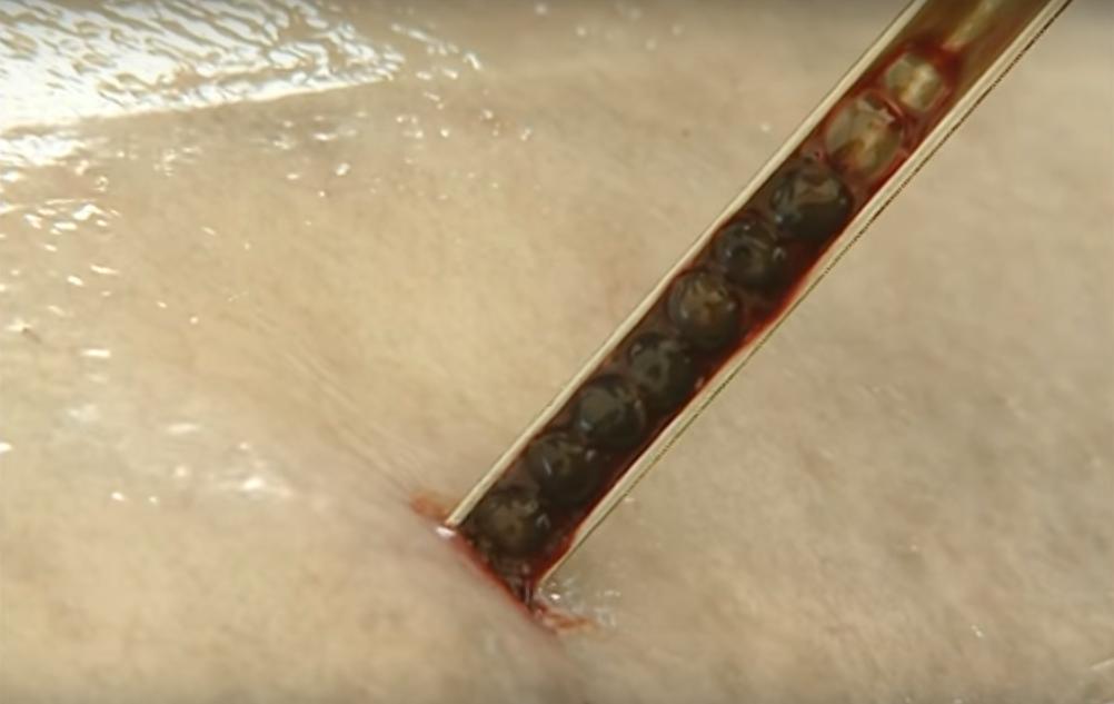 顶级鱼子酱美食,四大美食之一的鱼子酱