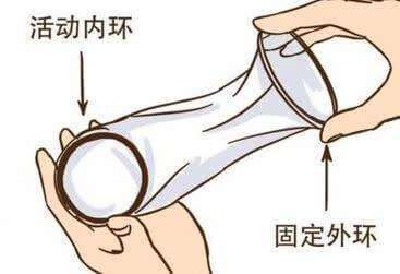 科普世界避孕日,世界避孕日活动注意事项