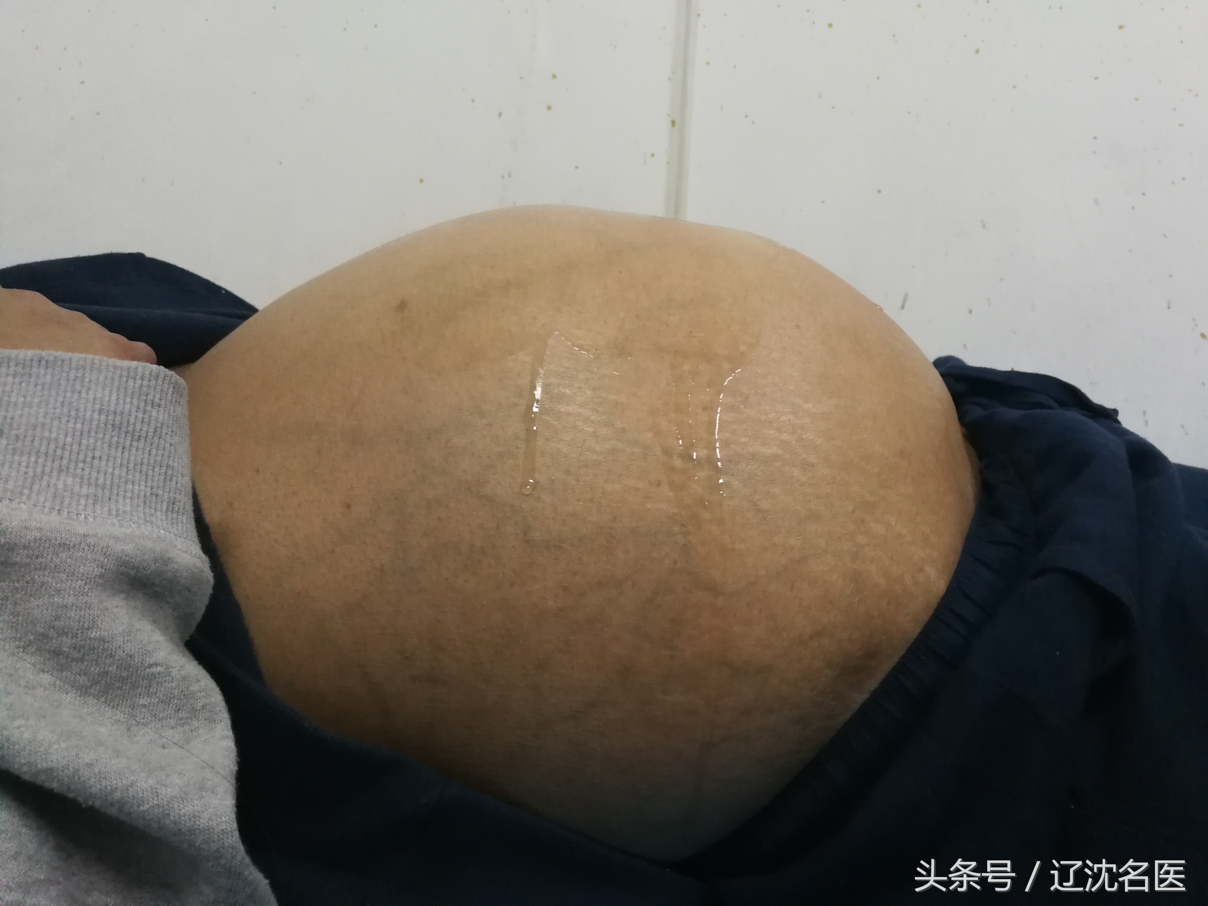 女性这个器官除了能生孩子，还被医生巧妙利用，独特手术全靠它！