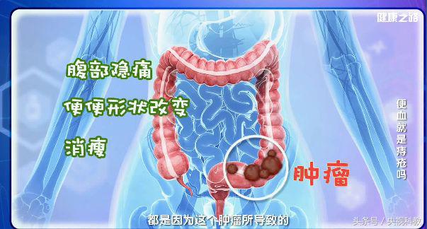便血警惕六种病,便血最常见的原因及辨别方法