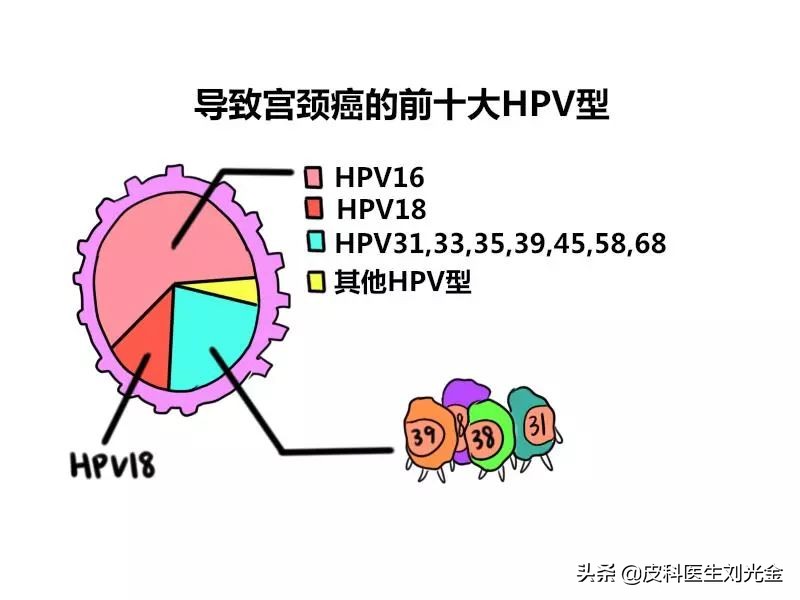 几乎所有宫颈癌都是由hpv感染的吗,hpv宫颈癌是什么