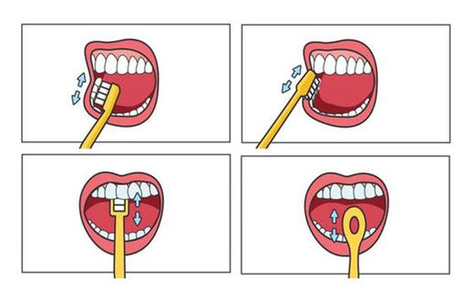 牙龈萎缩导致塞牙最好的解决办法,牙龈萎缩前牙黑三角严重如何修复