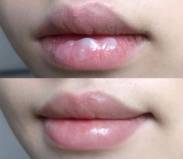 好用滋润的唇膏推荐曼秀雷敦,润唇膏推荐学生平价曼秀雷敦