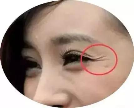 如何淡化眼纹记住这七大实用方法,已有眼纹该如何护理