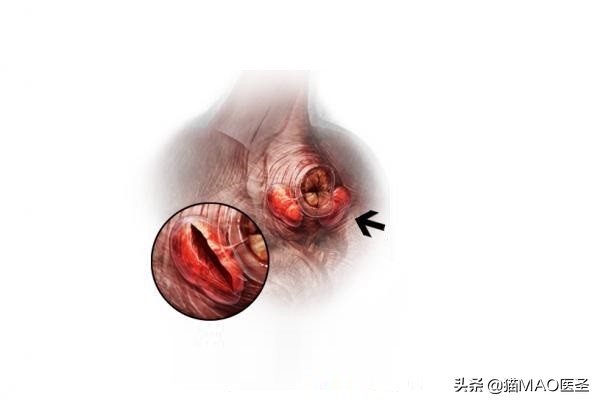 猫咪肛周瘘管什么疾病？是的猫咪不断的蹭屁股或者舔屁股